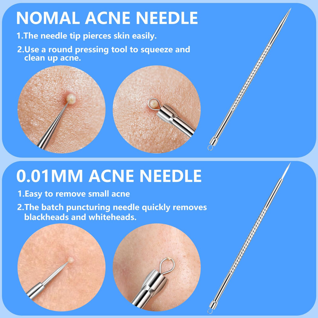 Remover Comedone Extractor Kit 5 Piece — Professional Stainless Steel Pimple & A